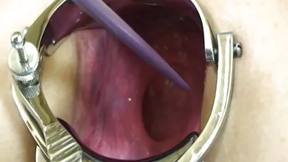 Фістинг шльет на трійку